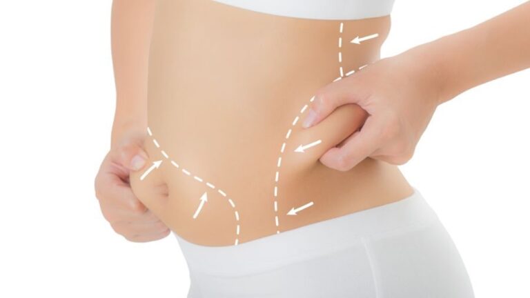 Kalıcı Yağlarınıza En Kalıcı Çözüm Liposuction