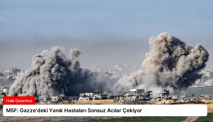 MSF: Gazze’deki Yanık Hastaları Sonsuz Acılar Çekiyor