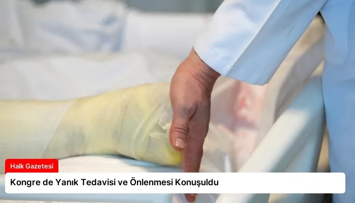 Kongre de Yanık Tedavisi ve Önlenmesi Konuşuldu