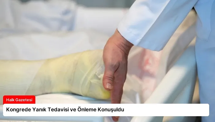 Kongrede Yanık Tedavisi ve Önleme Konuşuldu