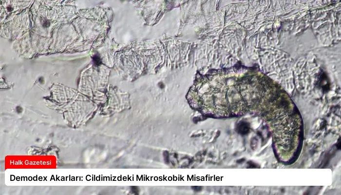 Demodex Akarları: Cildimizdeki Mikroskobik Misafirler
