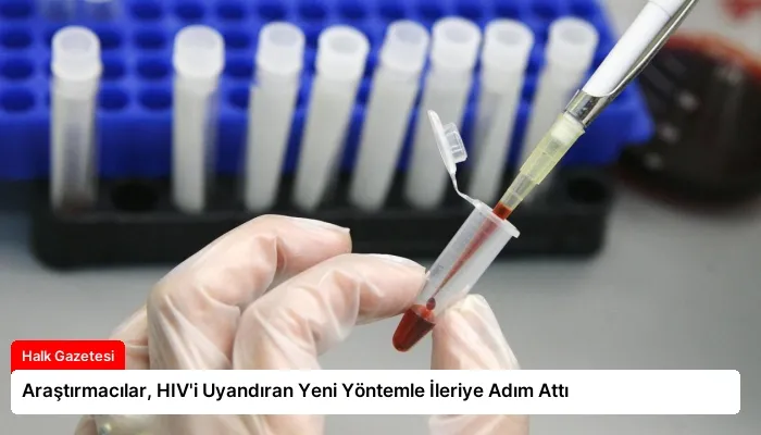 Araştırmacılar, HIV’i Uyandıran Yeni Yöntemle İleriye Adım Attı