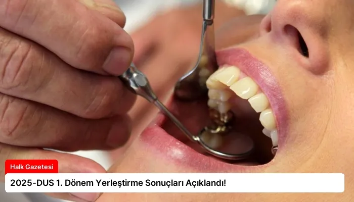 2025-DUS 1. Dönem Yerleştirme Sonuçları Açıklandı!