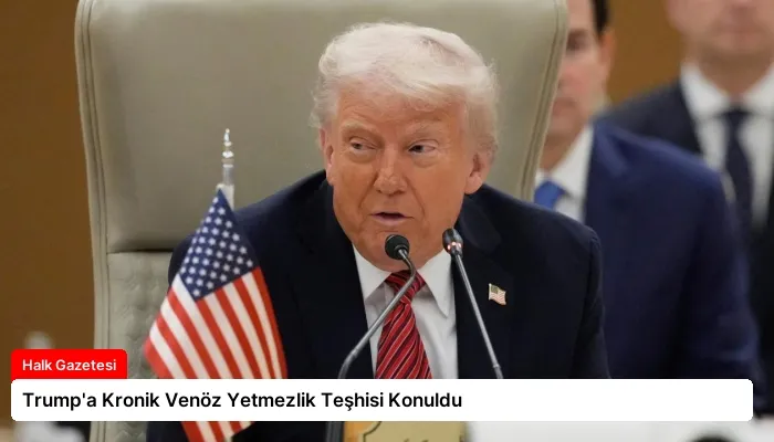 Trump’a Kronik Venöz Yetmezlik Teşhisi Konuldu