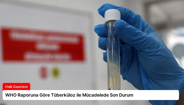 WHO Raporuna Göre Tüberküloz ile Mücadelede Son Durum