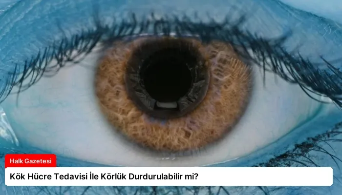 Kök Hücre Tedavisi İle Körlük Durdurulabilir mi?