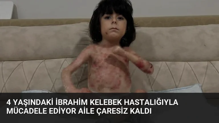 4 Yaşındaki İbrahim Kelebek Hastalığıyla Mücadele Ediyor Aile Çaresiz Kaldı