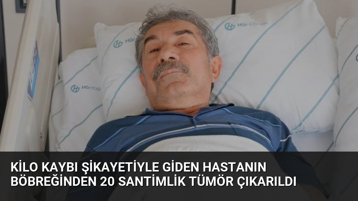 Kilo Kaybı Şikayetiyle Giden Hastanın Böbreğinden 20 Santimlik Tümör Çıkarıldı