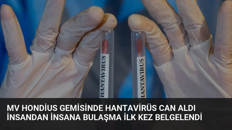 MV Hondius Gemisinde Hantavirüs Can Aldı İnsandan İnsana Bulaşma İlk Kez Belgelendi
