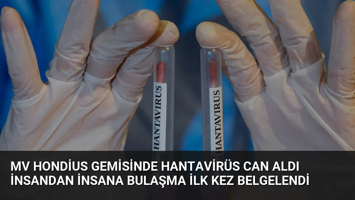 MV Hondius Gemisinde Hantavirüs Can Aldı İnsandan İnsana Bulaşma İlk Kez Belgelendi