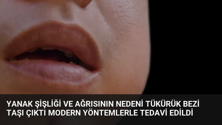 Yanak Şişliği ve Ağrısının Nedeni Tükürük Bezi Taşı Çıktı Modern Yöntemlerle Tedavi Edildi