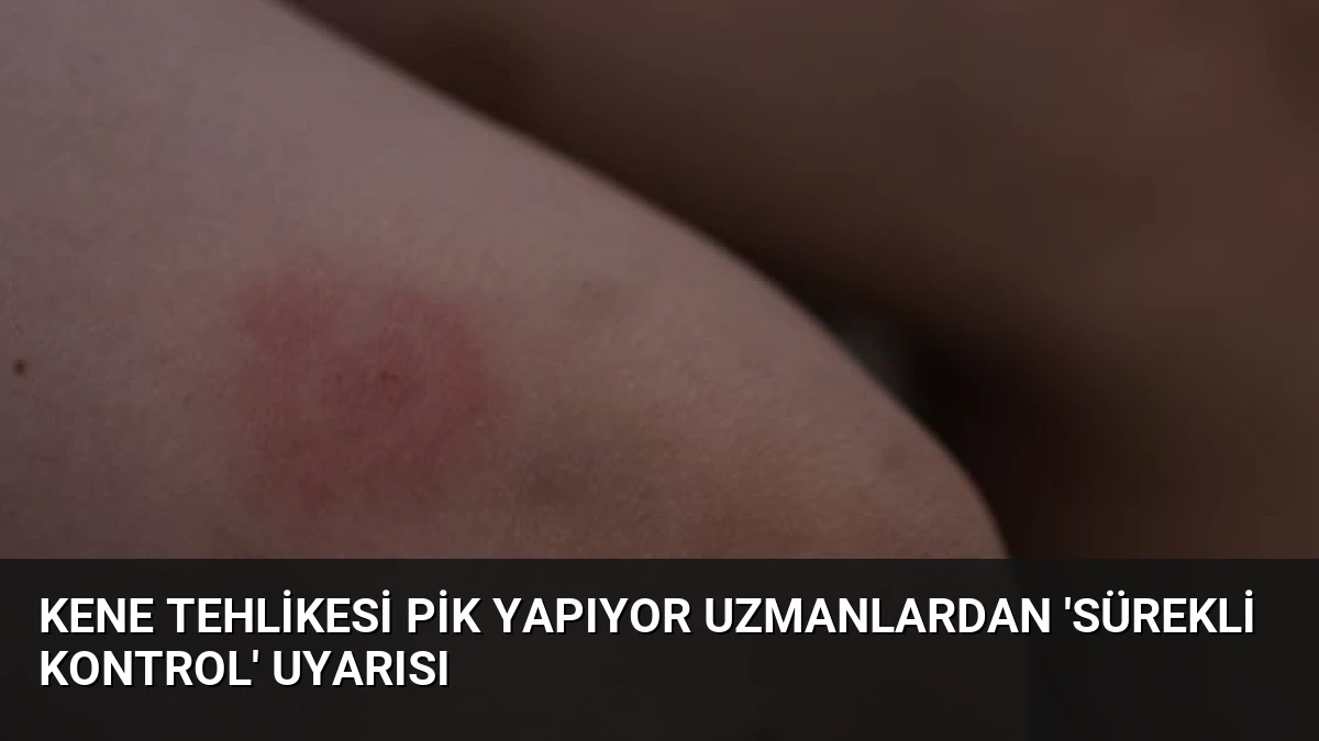 Kene Tehlikesi Pik Yapıyor Uzmanlardan ‘Sürekli Kontrol’ Uyarısı